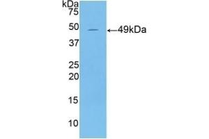 Detection of Recombinant KRT18, Mouse using Polyclonal Antibody to Cytokeratin 18 (CK18)