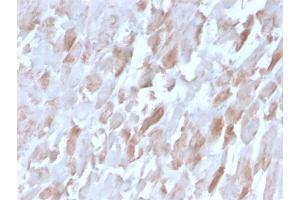 Formalin-fixed, paraffin-embedded human Cardiac Muscle stained with Sarcomeric Actinin Alpha 2 Mouse Monoclonal Antibody (ACTN2/3291). (ACTN2 anticorps  (AA 557-692))