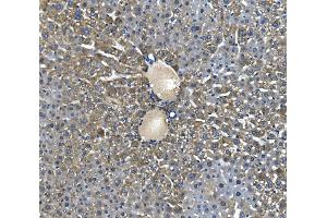 IHC analysis of Glycine decarboxylase/GLDC using anti-Glycine decarboxylase/GLDC antibody (ABIN7602073). (GLDC anticorps  (AA 574-1020))