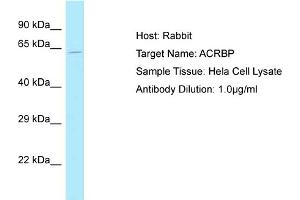 Host: Rabbit Target Name: ACRBP Sample Tissue: Human Hela Whole Cell Antibody Dilution: 1ug/ml (ACRBP anticorps  (N-Term))