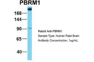 Host: Rabbit Target Name: NOP56 Sample Type: Human Fetal Brain Antibody Dilution: 1. (Polybromo 1 anticorps  (Middle Region))