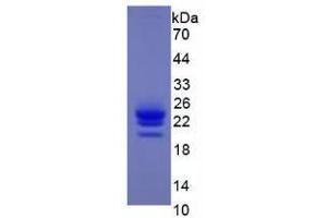 Image no. 1 for Interferon alpha (IFNA) (AA 24-189) (Active) protein (His tag) (ABIN6239752)