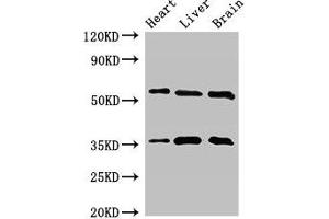 Western Blot Positive WB detected in: Mouse heart tissue, Mouse liver tissue, Mouse brain tissue All lanes: STK35 antibody at 2.