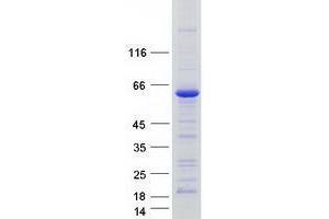 Validation with Western Blot