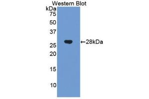 Detection of Recombinant CHRD, Human using Polyclonal Antibody to Chordin (CHRD)