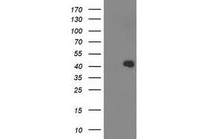 Western Blotting (WB) image for anti-Aldolase B, Fructose-Bisphosphate (ALDOB) antibody (ABIN1496607)