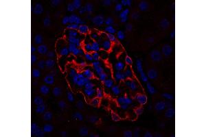 Immunostaining of a paraffin embedded mouse kidney section (dilution 1 : 200; red). (SYNPO anticorps  (Isoform 2))