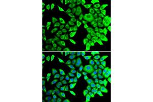Immunofluorescence analysis of A549 cells using THADA antibody. (THADA anticorps)