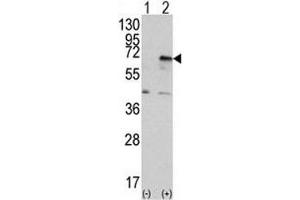 Western blot analysis of PRKR antibody and 293 cell lysate (2 ug/lane) either nontransfected (Lane 1) or transiently transfected with the EIF2AK2/PKR gene (2). (EIF2AK2 anticorps  (AA 519-550))