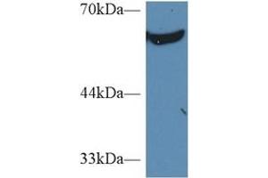 Rabbit Capture antibody from the kit in WB with Positive Control: Sample Human K562 cell lysate.