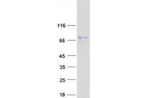 Validation with Western Blot
