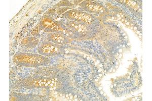 ABIN6265092 and ABIN6268681 at 1/100 staining Rat colon tissue by IHC-P. (SIRT3 anticorps  (C-Term))