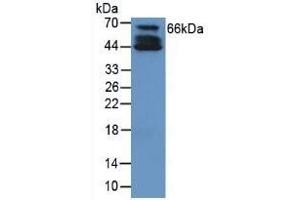 Detection of COL10 in Human Cartilage Tissue using Polyclonal Antibody to Collagen Type X (COL10) (COL10 anticorps  (AA 547-680))