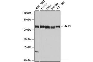 Western blot analysis of extracts of various cell lines using MARS Polyclonal Antibody at dilution of 1:1000. (Mars (MARS) anticorps)