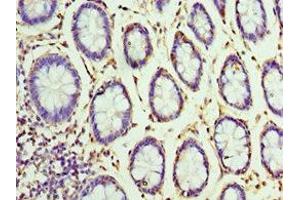 Immunohistochemistry of paraffin-embedded human colon tissue using ABIN7155860 at dilution of 1:100