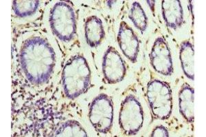 Immunohistochemistry of paraffin-embedded human colon tissue using ABIN7155860 at dilution of 1:100 (VENTX anticorps  (AA 1-258))