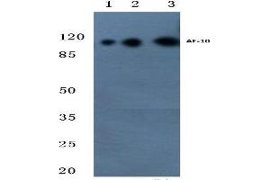 Western blot (WB) analysis of AF-10 antibody at 1/500 dilution. (MLLT10 anticorps)
