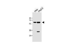 All lanes : Anti-hIL1R-p at 1:1000 dilution Lane 1: Hela whole cell lysate Lane 2: HepG2 whole cell lysate Lysates/proteins at 40 μg per lane.