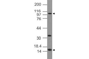 Image no. 1 for anti-DNA (Cytosine-5-)-Methyltransferase 3 alpha (DNMT3A) antibody (ABIN5027477) (DNMT3A anticorps)