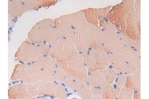 Detection of TXNIP in Mouse Skeletal muscle Tissue using Polyclonal Antibody to Thioredoxin-interacting Protein (TXNIP)