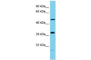 Host: Rabbit Target Name: C6orf211 Sample Type: MCF7 Whole Cell lysates Antibody Dilution: 1. (C6ORF211 anticorps  (N-Term))