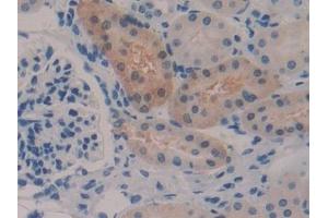 Detection of GSTa2 in Mouse Kidney Tissue using Polyclonal Antibody to Glutathione S Transferase Alpha 2 (GSTa2)