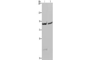 Western Blotting (WB) image for anti-Glycogen Synthase 1 (Muscle) (GYS1) antibody (ABIN2423549) (Glycogen Synthase 1 anticorps)