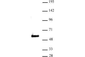 SMARCE1 antibody (pAb) tested by Western blot. (SMARCE1 anticorps  (C-Term))