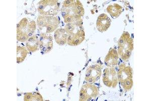 Immunohistochemistry of paraffin-embedded Human stomach using RHOB Polyclonal Antibody at dilution of 1:100 (40x lens). (RHOB anticorps)