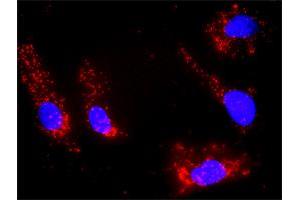 Proximity Ligation Analysis of protein-protein interactions between IL21 and DGKA.