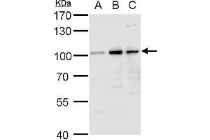 WB Image Aconitase 1 antibody detects Aconitase 1 protein by western blot analysis. (Aconitase 1 anticorps)