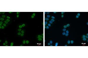 ICC/IF Image ZNF45 antibody [N2C3] detects ZNF45 protein at nucleus by immunofluorescent analysis. (ZNF45 anticorps)