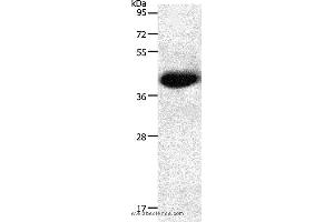 Western blot analysis of Mouse heart tissue, using NGFR Polyclonal Antibody at dilution of 1:950 (NGFR anticorps)