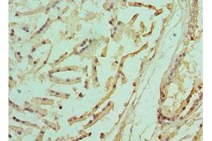 Immunohistochemistry of paraffin-embedded human prostate tissue using ABIN7142216 at dilution of 1:100 (PSMD5 anticorps  (Regulatory Subunit 5))