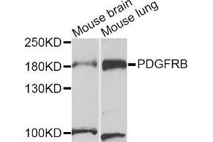 Western blot analysis of extracts of mouse brain and mouse lung cell lines, using PDGFRB antibody. (PDGFRB anticorps)