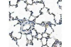 IHC analysis of FOXF1 using anti-FOXF1 antibody (ABIN7601744). (FOXF1 anticorps  (AA 44-379))