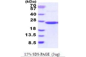 SDS-PAGE (SDS) image for CD58 (CD58) (AA 29-215) protein (His tag) (ABIN5854000)
