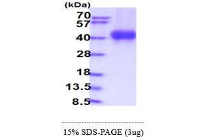 SDS-PAGE (SDS) image for Interleukin 2 Receptor, gamma (IL2RG) (AA 23-262) protein (His tag) (ABIN5854210)
