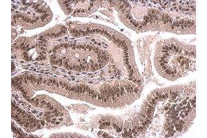 IHC-P Image SNRPD2 antibody detects SNRPD2 protein at nucleus on mouse duodenum by immunohistochemical analysis.