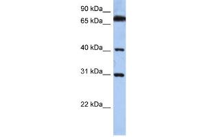 WB Suggested Anti-DHRSX Antibody Titration: 0.
