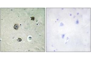 Immunohistochemistry analysis of paraffin-embedded human brain tissue, using CDK5 (Ab-15) Antibody.