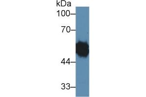 Detection of LYAR in Rat Testis lysate using Polyclonal Antibody to Ly1 Antibody Reactive Homolog (LYAR)