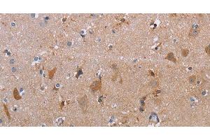 Immunohistochemistry of paraffin-embedded Human brain using MAGEF1 Polyclonal Antibody at dilution of 1:30 (MAGEF1 anticorps)