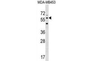 Western Blotting (WB) image for anti-Leucine Rich Repeat Transmembrane Neuronal 2 (LRRTM2) antibody (ABIN3000490) (LRRTM2 anticorps)