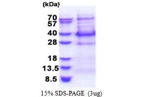 SDS-PAGE (SDS) image for B-Cell CLL/lymphoma 7C (BCL7C) (AA 1-217) protein (His tag) (ABIN5853394)