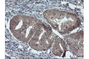 Image no. 3 for anti-Fragile X Mental Retardation 1 (FMR1) (AA 26-279) antibody (ABIN1491292)