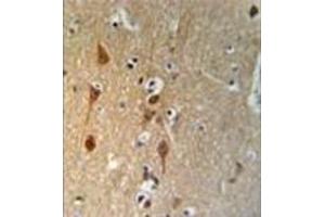 formalin fixed, paraffin embedded brain tissue stained with SMAD3 Antibody  followed by peroxidase conjugation of the secondary antibody and DAB staining.