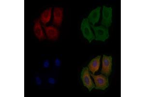 ABIN6263362 and ABIN6279017 staining Hela cells by IF/ICC.