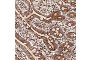 Immunohistochemical staining of human duodenum with C14orf45 polyclonal antibody  shows strong cytoplasmic positivity in glandular cells. (C14orf45 anticorps)