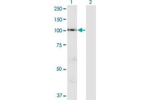 Western Blot analysis of VPS41 expression in transfected 293T cell line by VPS41 polyclonal antibody (A01). (VPS41 anticorps  (AA 755-853))